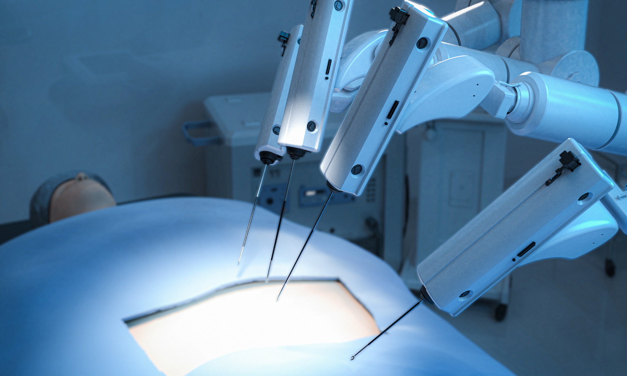 Revolutionizing Precision Surgery: The Role Of Robotics In Modern ...